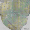 A human spinal tissue sample. On top of the image are a series of colored spots representative of gene expression.