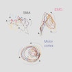 Supplementary motor area (SMA), motor cortex and muscle cells (EMG) in a figure.