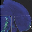Principal neurons of the entorhinal cortex layer II assist with memory and navigation and are among the most vulnerable to Alzheimer’s. Researchers generated a line of mice for studying ECII neurons (highlighted using a green fluorescent protein). The neurons are at such high risk because they frequently remodel, making them prone to fatal dysfunctions, the researchers found.