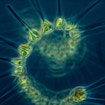 A chain-forming diatom, a common type of phytoplankton, found in the Northeast