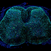 slice showing gene expression in neurons of a mouse brain.