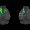 brain with rainbow imaging